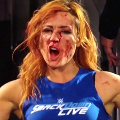 The Moment Becky Lynch's 'Face Broke’ in a WWE Match